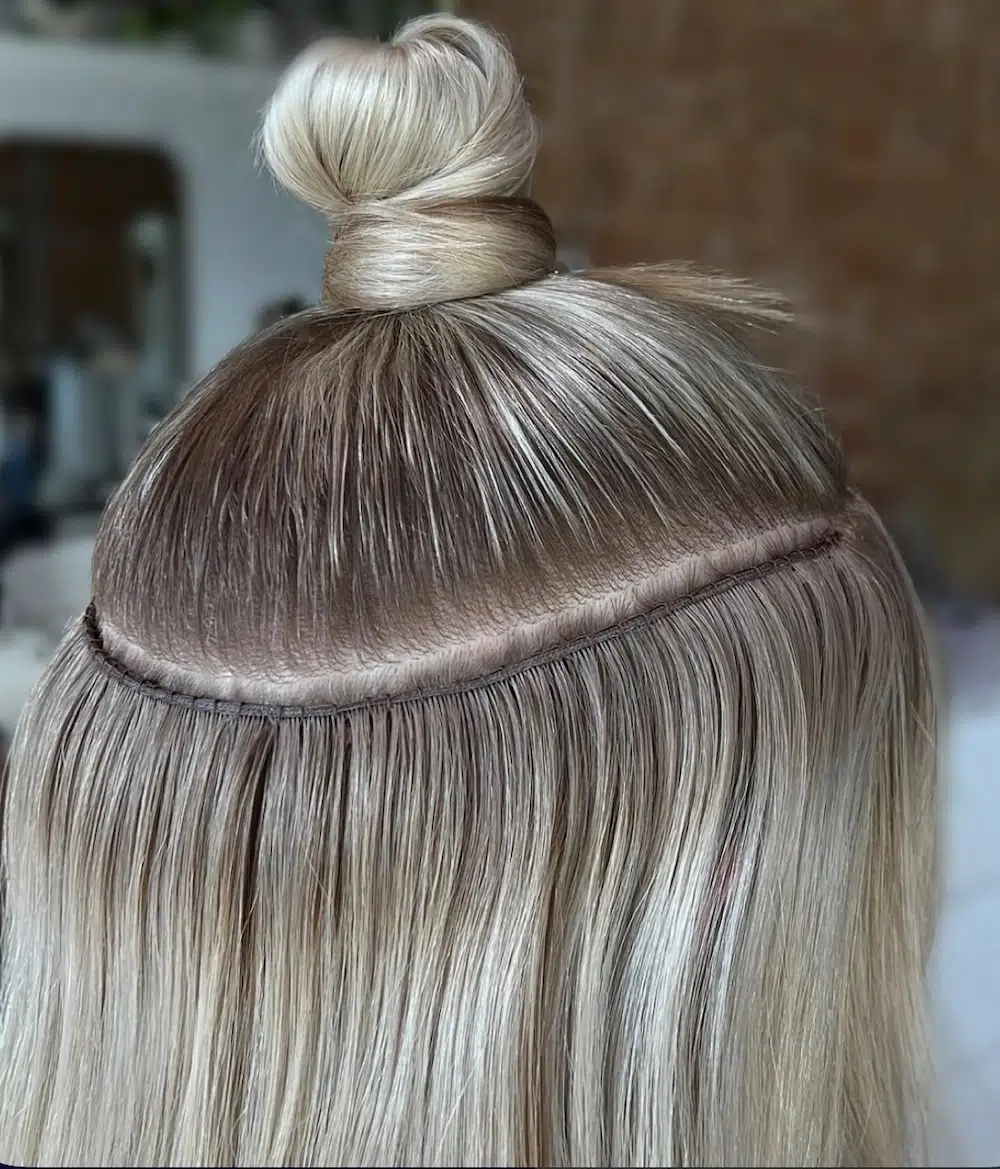 Extension removal McKinney